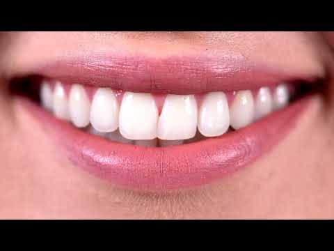 Vista previa del video de la clinica dental