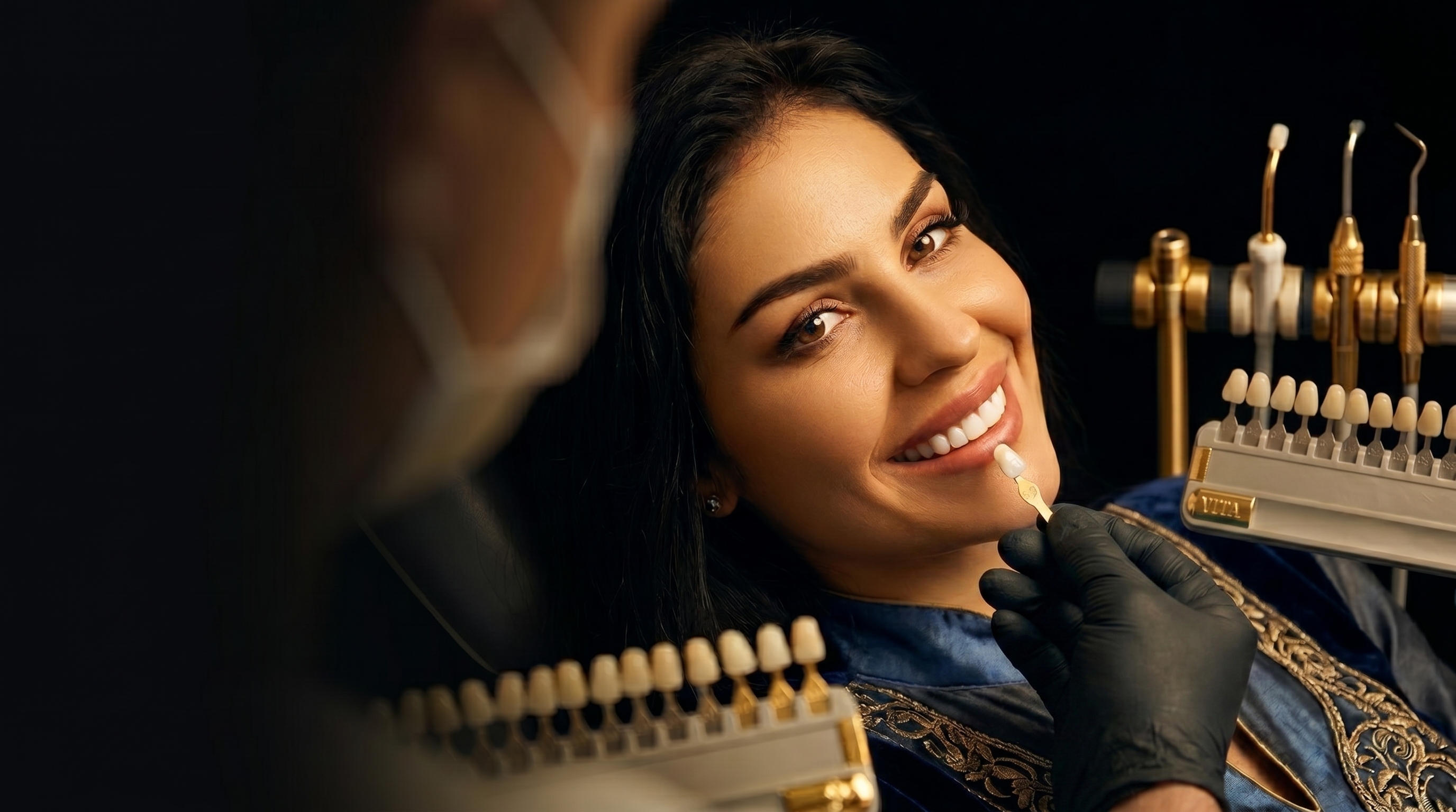 Comparación de color dental para tratamiento de carillas estéticas